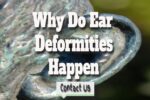 Why Do Ear Deformities Happen – Do Ears Change As You Get Older