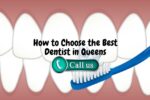 How to Choose the Best Dentist in Queens