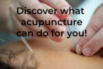 Acupuncturists: What Can They Do For You?