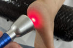 Laser Therapy: A High Intensity Treatment Option