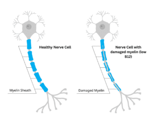 Nerve cell with myelin