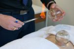 Cupping Therapy in Melbourne: Discover Healing Benefits