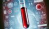 Vitamin B12 Blood Test Insights for Bridlington Locals