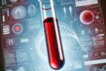 Vitamin B12 Blood Test Guide for Bridlington Residents