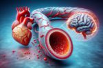 Cholesterol Blood Test: Your Essential Guide in Kings Lynn