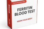 Ferritin Blood Test Guide for Redditch Residents