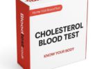 Cholesterol Blood Test: Essential Information for Birmingham Residents