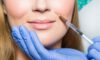 Lip Filler Simulation: Visualise Your Perfect Look!