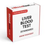 Liver Blood Test Results: Insights for Gateshead Residents